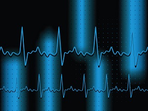 Application Monitoring Beyond The Data Center